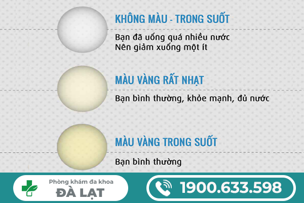 Hình ảnh minh họa